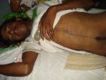Scratches on the chest of victim Nijammudin